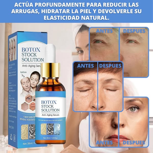 Botox Stock Solution